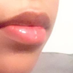 Lippe angeschwollen